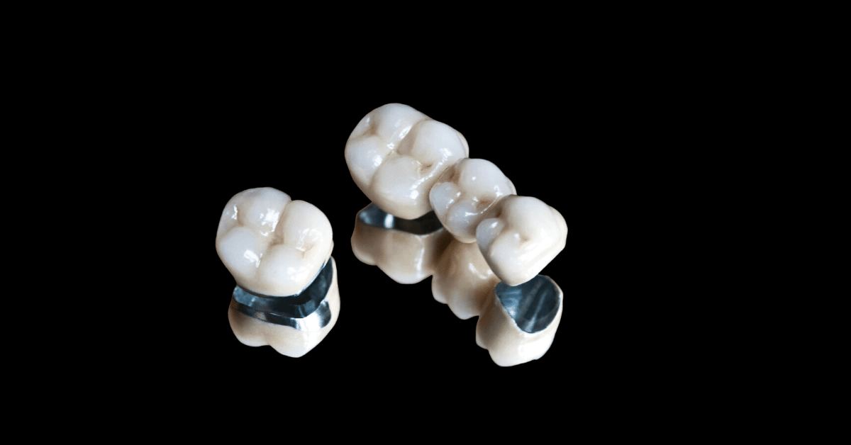 Dental crowns and bridges restoration